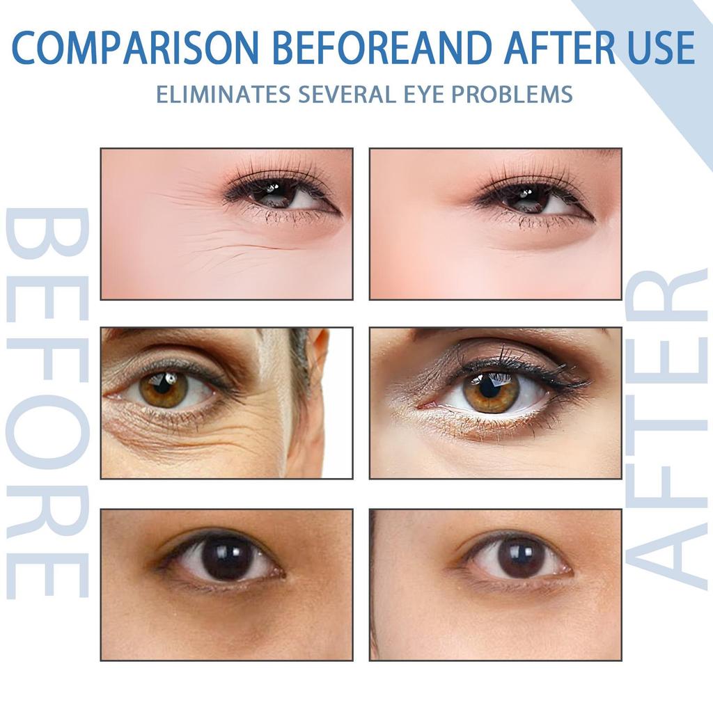 Peptide Eye Serum Reduce Fine Line Dark Circle Improve Skin Elasticity Crow’s Feet Eye Bag Removal Anti-Puffiness Under Eye Care