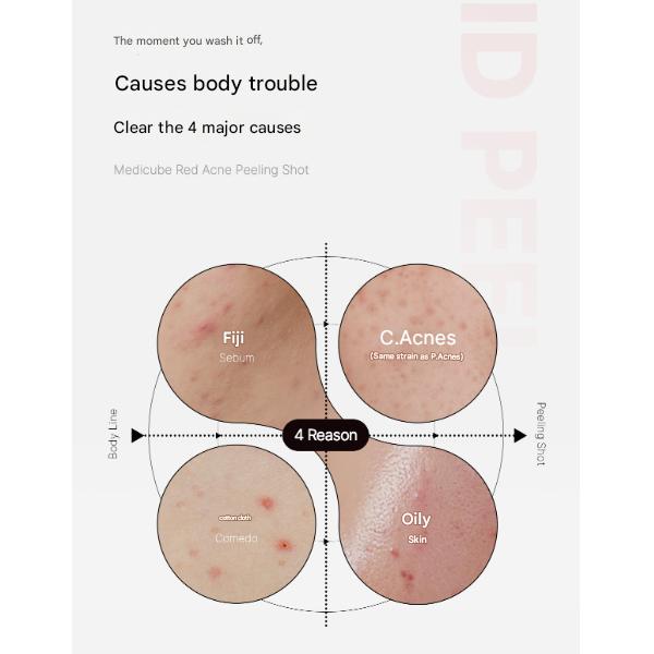 Medicube Body Pigmentation Intensive Care Set (Red Acne Body Peeling Shot 110g / Red Clear Capsule Body Lotion 230ml) (7 Options)