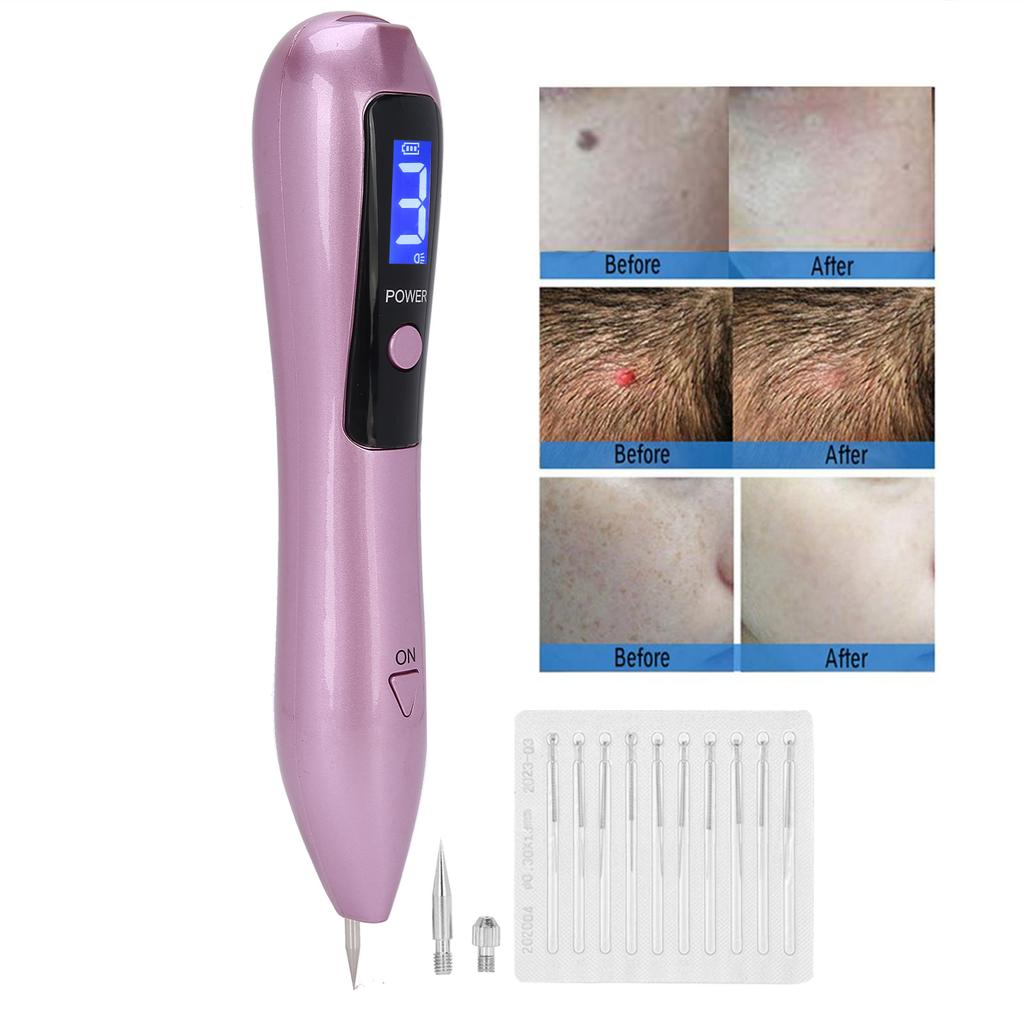 Muttermalentferner Stift USB Wiederaufladbar Sommersprossenentferner Maschine Gesichtsschönheitsinstrument