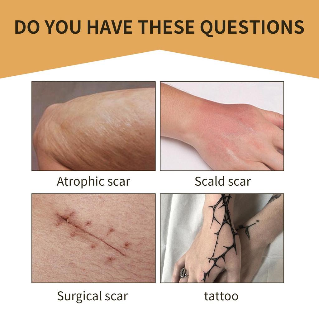 6PCS Waterproof Tattoo Film Ultra Thin Patch Tattoo Scar Cover Tapes Concealing Acne Tattoo Up Compression Accessories Flaw