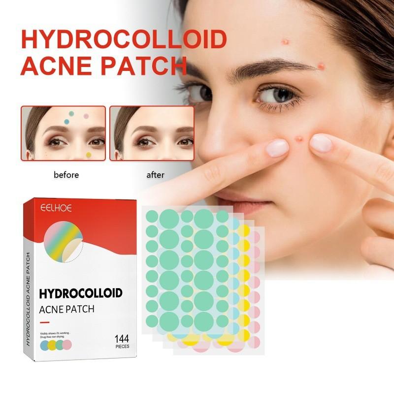 Eelhoe Colorful Acne Patches Gentle Non-irritating Hydrocolloid Treatment For Blemishes And Pimples 144pcs
