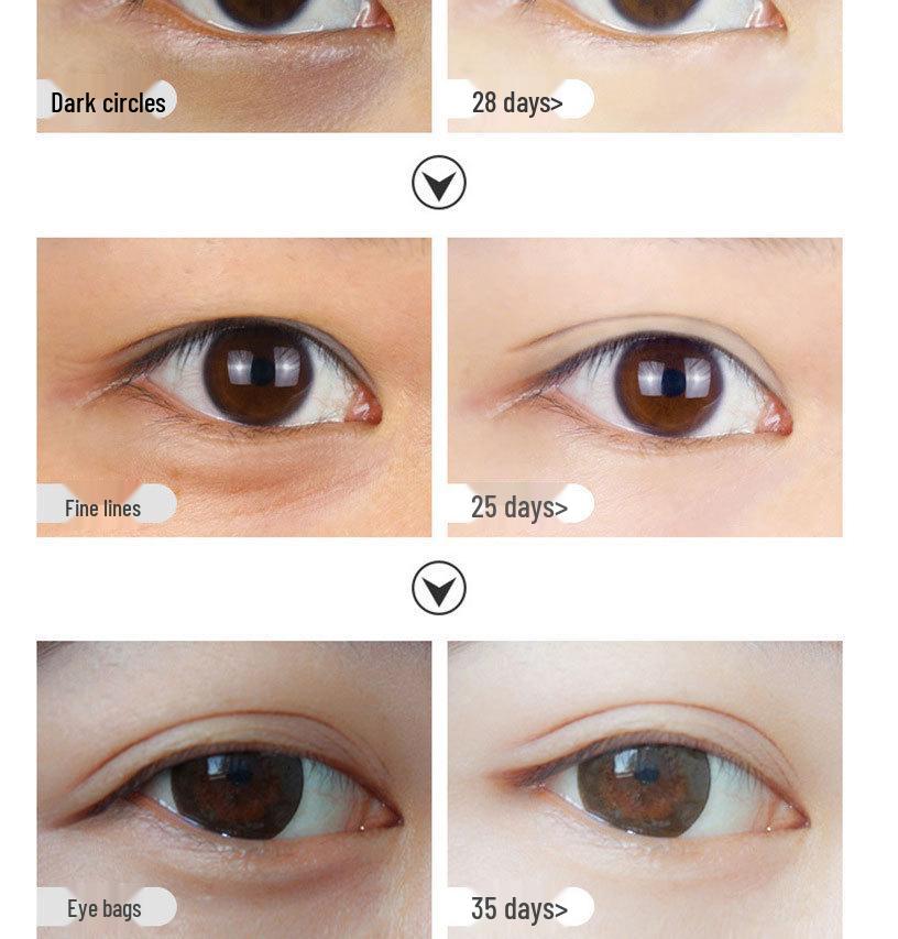 Anti-Wrinkle Eye Cream: Reduces Fine Lines, Bags, Tear Troughs & Crow's Feet; Moisturizes, Fades Dark Circles, Lifts & Firms