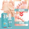 Jaysuing Athlete Foot Spray For Odor And Itching Relief With Soothing Freshness 50ml