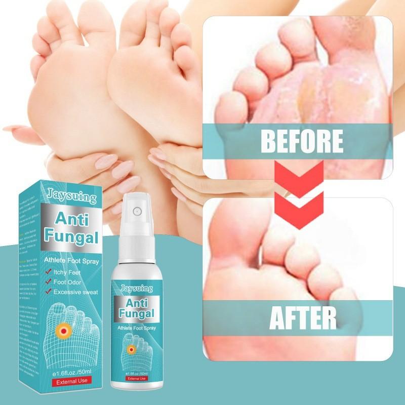 Jaysuing Athlete Foot Spray For Odor And Itching Relief With Soothing Freshness 50ml