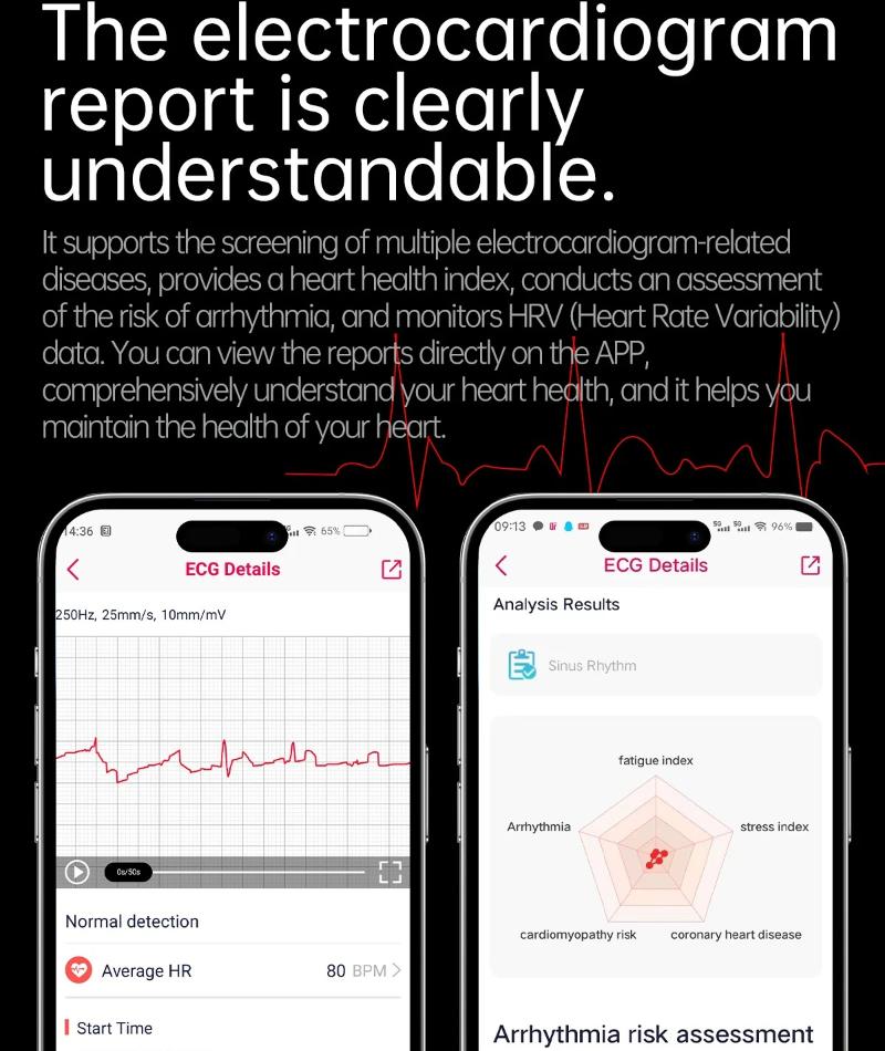 2026 NEW ECG Blood Oxygen Blood Pressure Temp Monitor Men Uric Acid Blood Fat Health Diagnosis HD Bluetooth Call Men Smart Watch