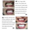 50 Ml Mousse Foam Toothpaste Whitening For Sensitive Teeth Deeply Cleaning Gums, Stain Removal Toothpaste 2025