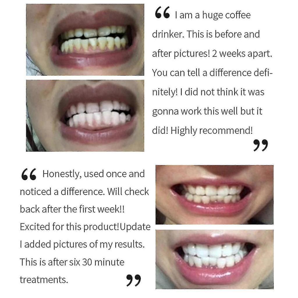 50 Ml Mousse Foam Toothpaste Whitening For Sensitive Teeth Deeply Cleaning Gums, Stain Removal Toothpaste 2025