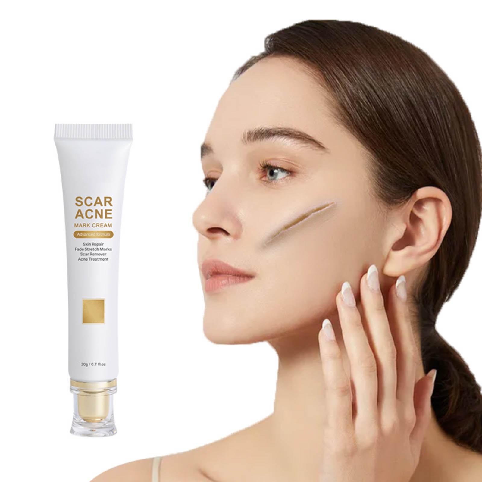 

Крем от рубцов на коже, крем против угревой сыпи 20 г One Size белый