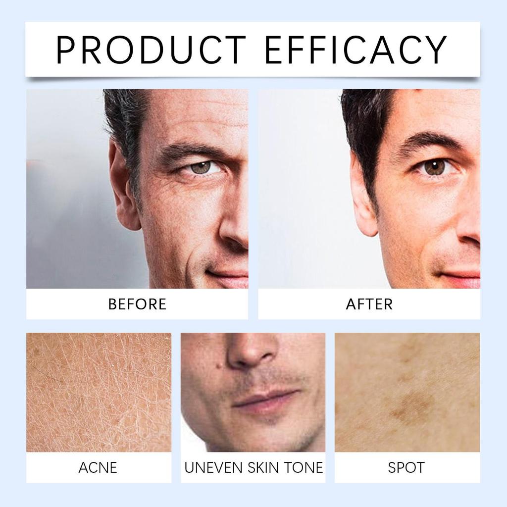 East Moon Men Face Firming Essence Lotion Anti Aging Reduce Fine Lines Wrinkles Hydrating Moisturizing Daily Skin Care 100ml