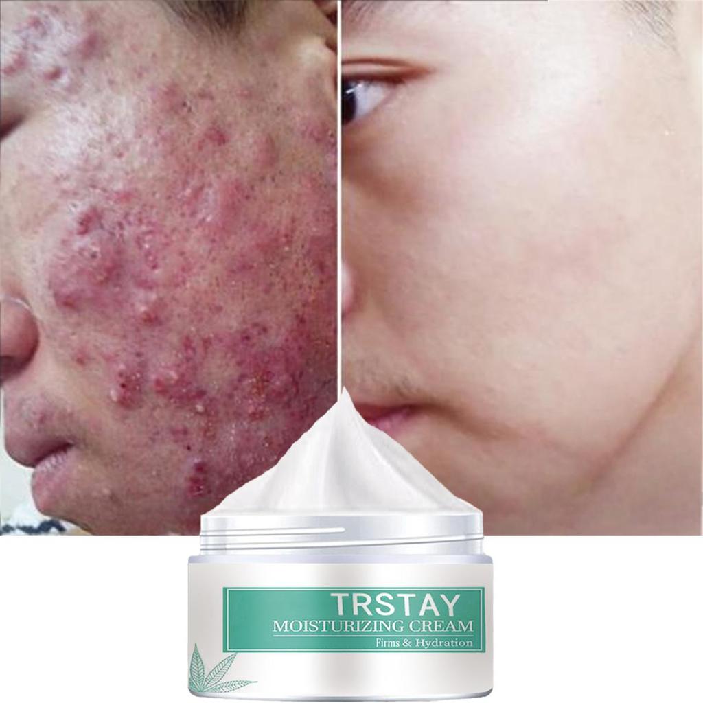 Gentle and Non-irritating, the Nourishing Skin Cream Tightens the Skin, Hydrates and Brightens the Complexion, Leaving the Skin Soft and Refined