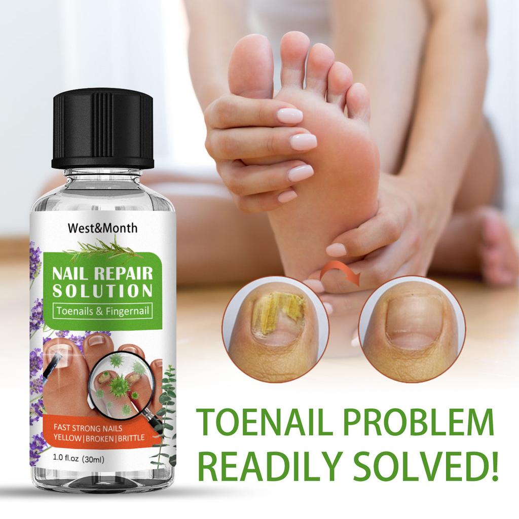 Toenail Fungus Care, FastActing Nail Care Liquid For Fungus Under & Around  Restores The Healthy Appearance Of Nails 30ml