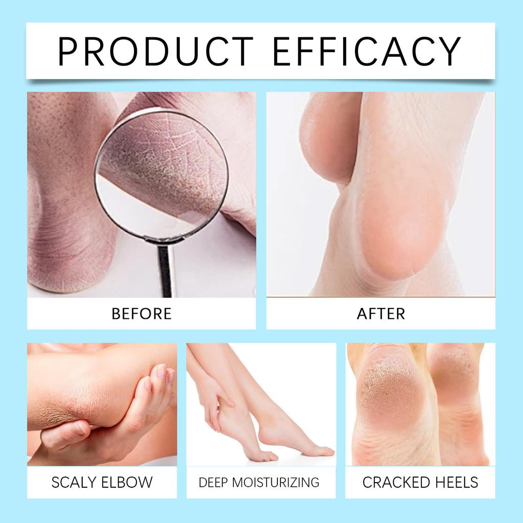 Wiyun Moisturizing Hand And Foot Care Cream For Soft Silky Skin Nourishing Hydration