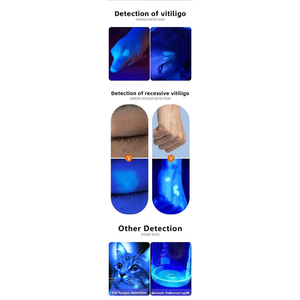 NEW UV Magnifying Woods Lamp Skin Analyzer Facial Beauty Testing Light for Skin Care Analysis Detection