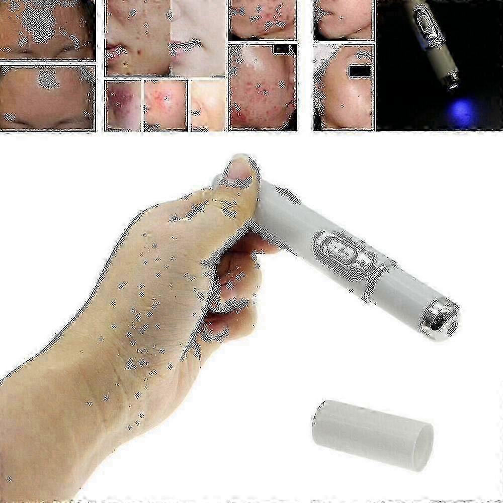 Laser Pen for Spider Vein Removal and Wrinkle Treatment