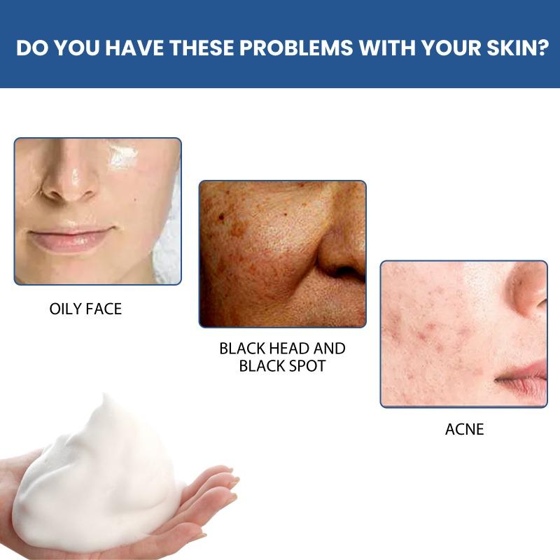 Rozjasňující a čisticí mléko na skvrny 150 g Deep Oil Control čistí póry, hydratuje a zvlhčuje pleť