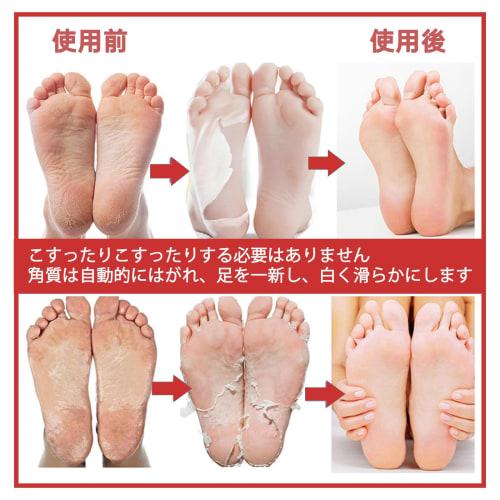 3 Pairs of Foot Exfoliating Masks, Foot Peeling Masks, Foot Exfoliation Masks, Foot Care Masks, Remove Dead Skin, Make Your Feet Smoother and More Bea