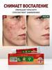 Cream for facial inflammation, acne and blackheads, for oily and problem skin, suitable for teenagers and adults, 15 g