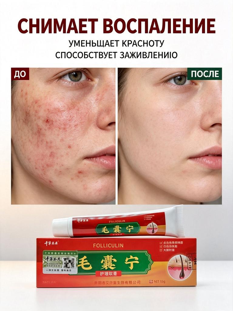 Cream for facial inflammation, acne and blackheads, for oily and problem skin, suitable for teenagers and adults, 15 g