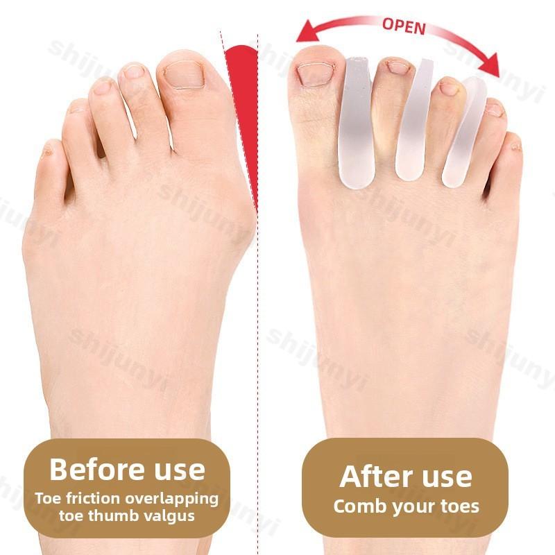 Fashion 2Pcs=1Pair Soft Gel A-shaped Toe Overlapping Separator Bunion Corrector Spacer Wear-resistant Foot Straightener Toe Stretcher