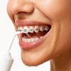 Wireless Dental Irrigator for the Oral Cavity, Set of 5 Tips