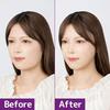 Classe Face Lift Up Black Cosplay Instant Subtle Eye Wrinkles Nasolabial Folds Correction Surgery