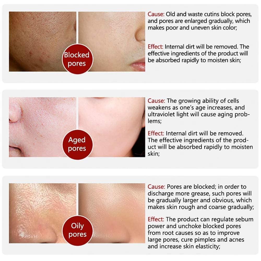 Beuking Pore Skin Care Serum Facial Essence For Shrinking Pores + Relieving Dryness + Oil Control Firming + Moisturizing  Face Care Product For Women