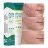 1PACK Salicylic Acid Azelaic Acid Gel Fades Acne Marks, Shrinks Pores, Removes Acne and Closes Ceramide Lactic Acid Acne Cream