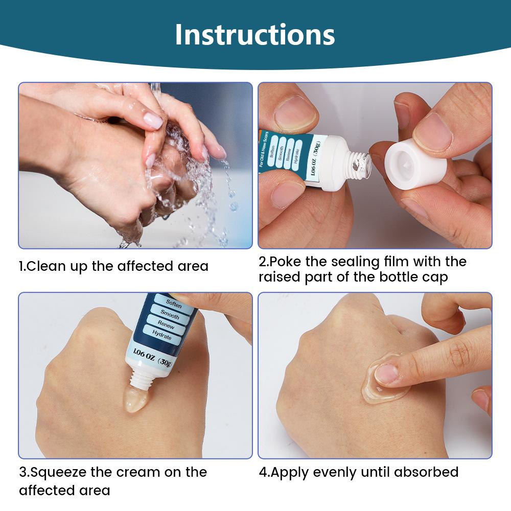 Pastă delicată pentru îndepărtarea cicatricilor și tratează arsurile, repararea cicatricilor, diminuarea gelului pentru cicatrici, pastă pentru reducerea cicatricilor pentru toate tipurile de piele