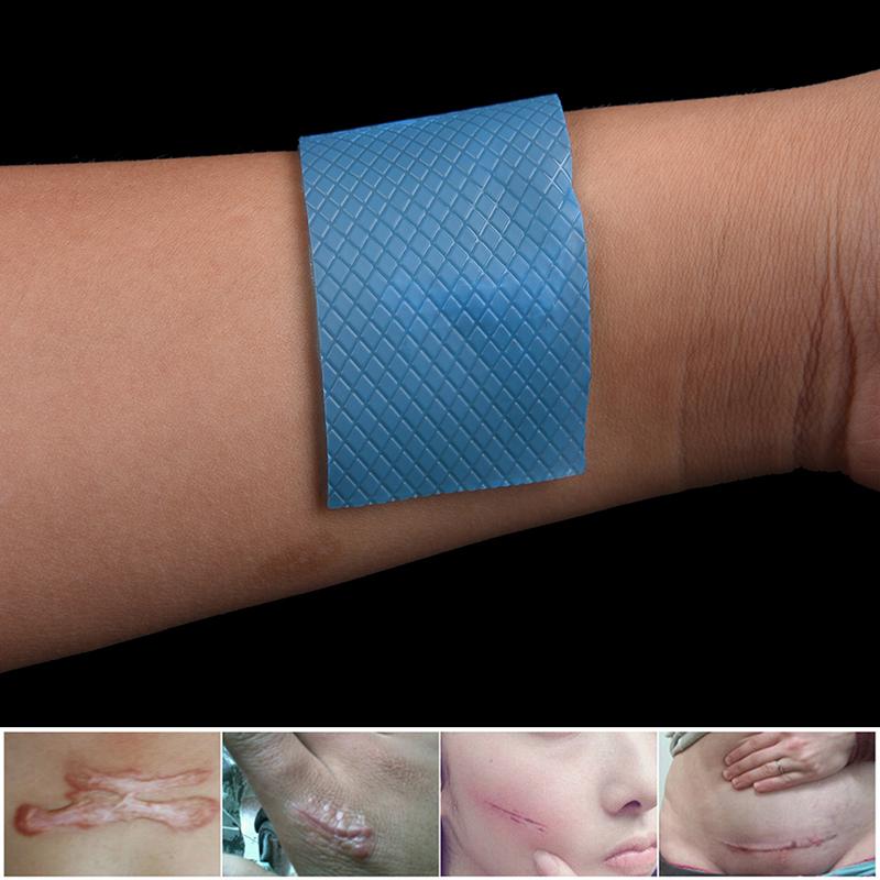 1Pc Scar Therapy Remove Trauma Burn Silicon Patch Reusable Acne Gel Skin Repair