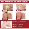 Effective Nail Repair  Moisturizing Solution for Healthy, FungusFree Nails