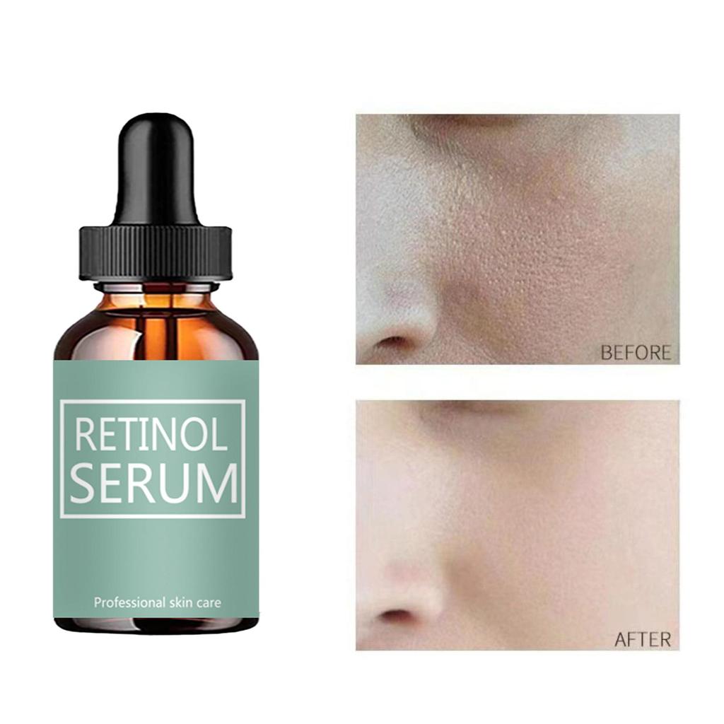 Anti Aging Face Cream, Rich In Collagen, Prevents Dry Lines, Moisturizes And Moisturizes