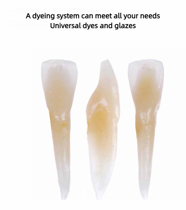 5g/Dose DS Sirona Universal Spot-On Glasur, Hochviskose Labor-Überglasurpaste für Keramik.