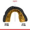 Opro Gold Braces GEN5 Black Mouthguard (for braces)