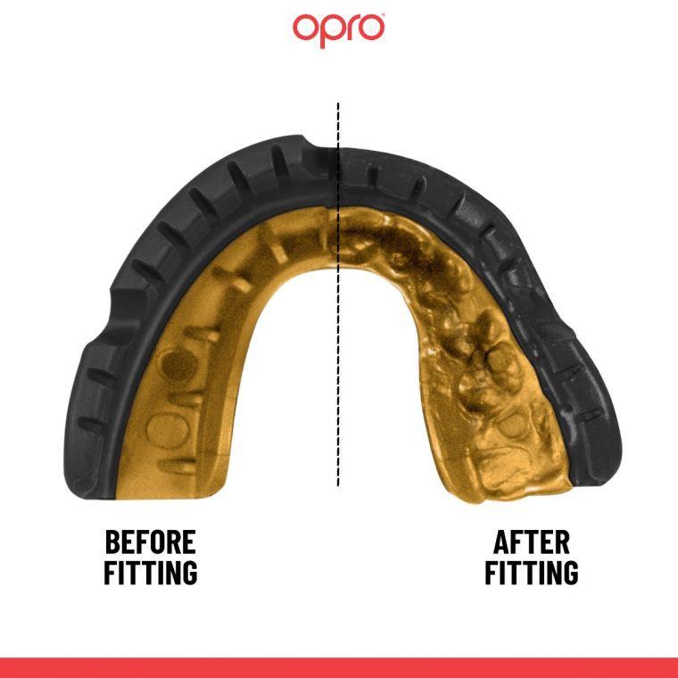Opro Gold Braces GEN5 Black Mouthguard (for braces)