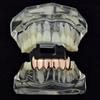 Hot-Selling HIPHOP Gold Grillz Decorative Teeth 