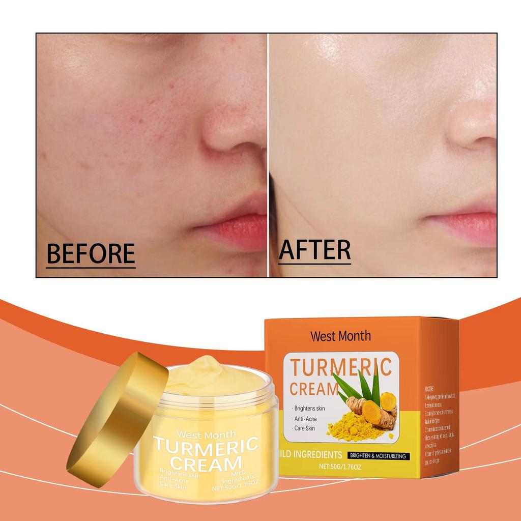 Turmeric Cream Urmeric Face Cream for Face Body - All Natural Turmeric Skin Brightening Lotion Prevent Pigmentation