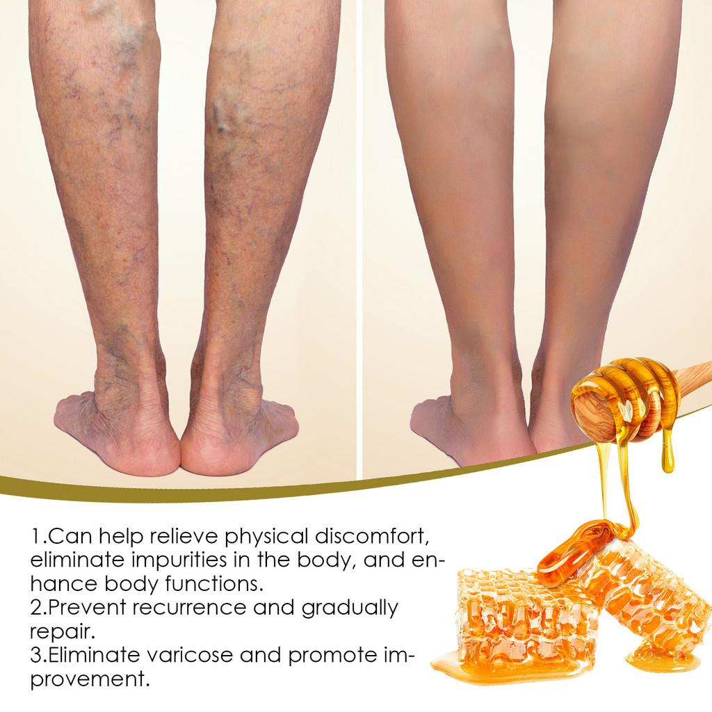 Honey Bee Venom Foot Soak Beads For Relaxing And Cleansing With Moisturizing Benefits
