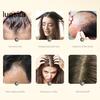 10Pcs 20ML Ginger Shampoo, Anti Hair Loss Gentle Men Women Baldness Treatment Hair Care Natural Ginger Plant Extract Hair Regrowth Shampoo