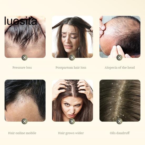 10Pcs 20ML Ginger Shampoo, Anti Hair Loss Gentle Men Women Baldness Treatment Hair Care Natural Ginger Plant Extract Hair Regrowth Shampoo