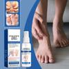 Athlete's Foot Spray Foot Sprays, Foot Care Sprays, Athlete's Foot Foot Odor, Relieves Itching, Peeling, Sweating, Blisters And Inflammation,60ML