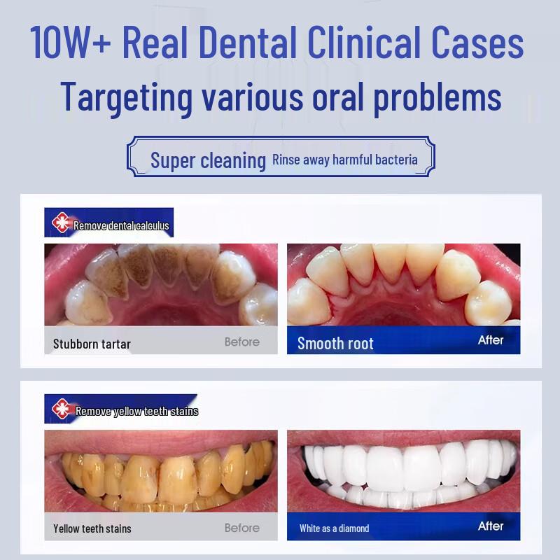 Jingpeitang Plaque & Calculus Removing Mouthwash