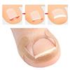 20-100pcs Adhesive Toenail Patch Ingrown Toe Nail Correction Sticker Foot Corrector Pedicure Health Care Tools Toe Treatment Pad