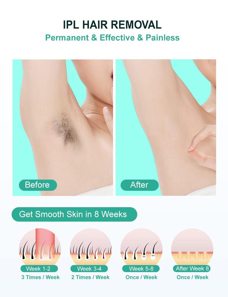 Permanent Laser Hair Removal Device with 999,999 Flashes for Face, Legs, Arms and Bikini Line