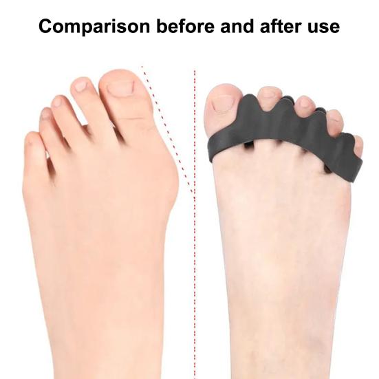 1 Paire Séparateur d'orteils Correcteur de pied Écarteurs Souples Élastiques Réglables Design à Cinq Trous Soulage les Cors aux Orteils, les Orteils en Marteau Accessoires Respirants pour le Soin des Pieds
