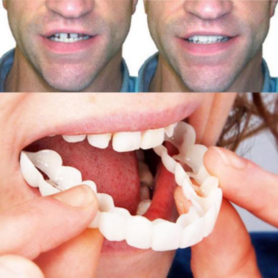 2Pcs Silicone Simulation Upper Bottom Teeth Denture Whitening Fake Tooth Cover