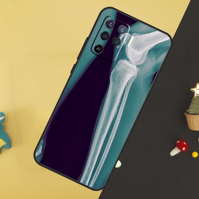 X-Ray Human Anatomy Case For Oppo A80 A60 A40 A54 A74 A94 A18 A38 A58 A78 A98 A96 A76 A16 A15 A17 A57 A5 A6 Pro