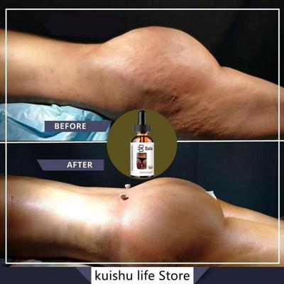 Transform Your Body with Our Al-Natural Formula for a Beautiful Skin and Curvy Shape