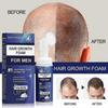 25-26 Regaine for Men Regrowth Scalp Foam