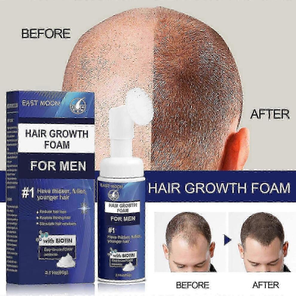 25-26 Regaine for Men Regrowth Scalp Foam