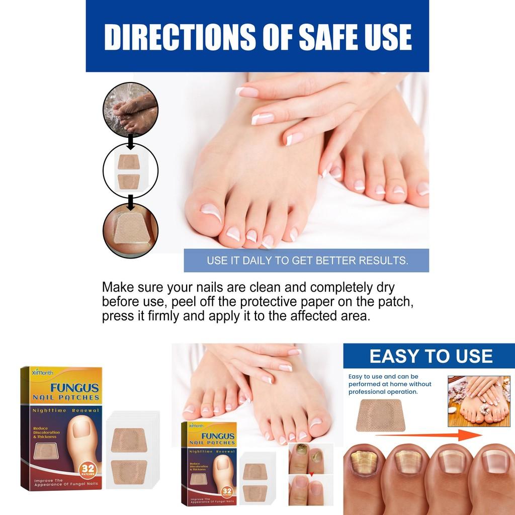 Ximonth Nagelpflege-Pflaster für gesunde Zehen und starke Nägel mit reparierender Formel